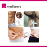 Meditrove Body Fat Caliper – Professional Skinfold Measurement Tool for Body Fat Analysis
